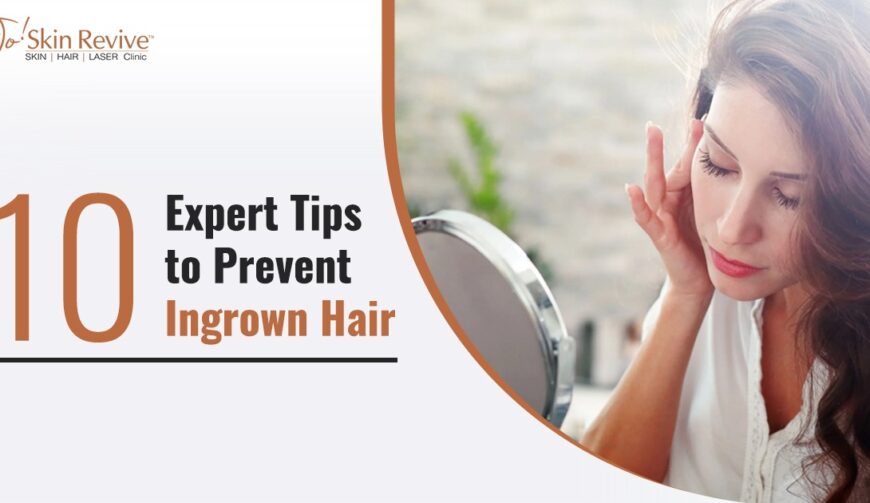 10 Expert Tips to Prevent Ingrown Hair